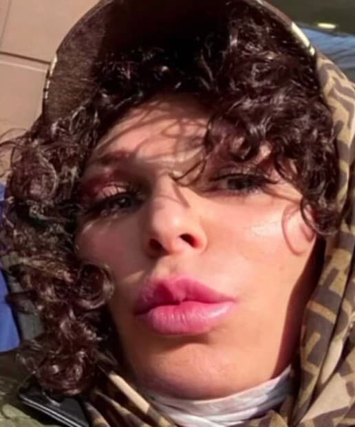 Жанна Агузарова вернула прежнюю внешность при помощи пластики